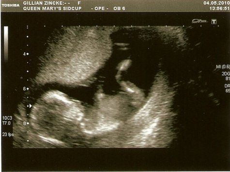 29880_420122647243_1267338_n